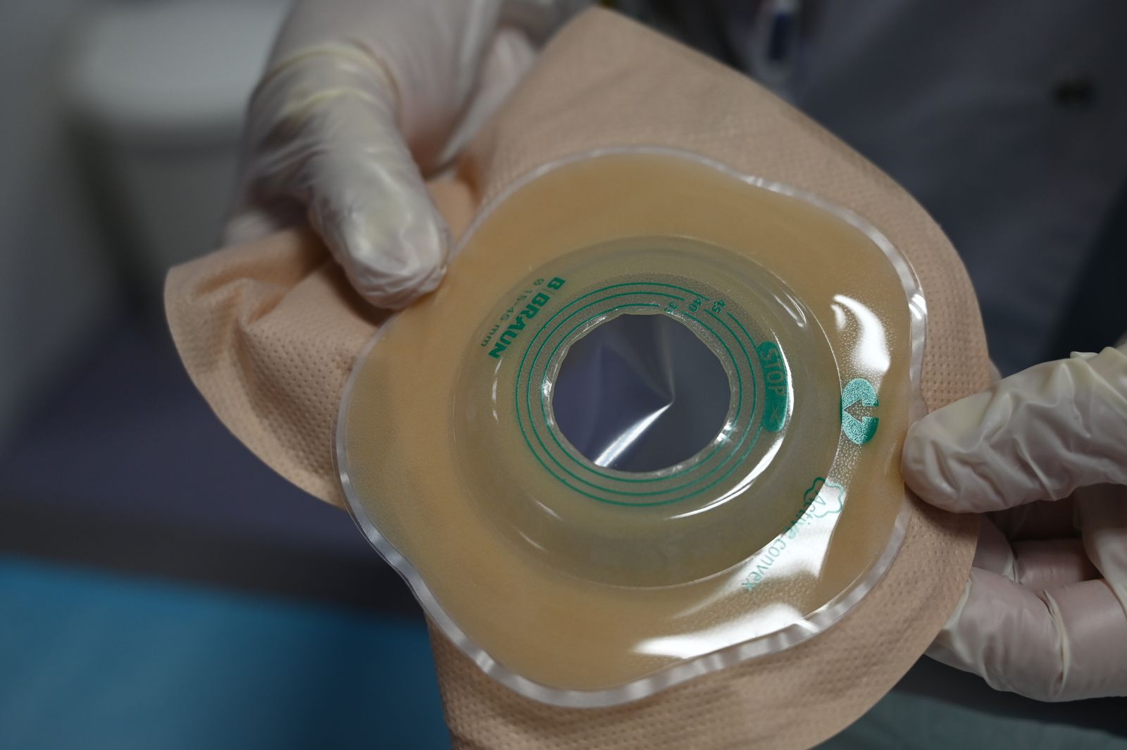 A healthcare professional holding an ostomy pouch for patient care